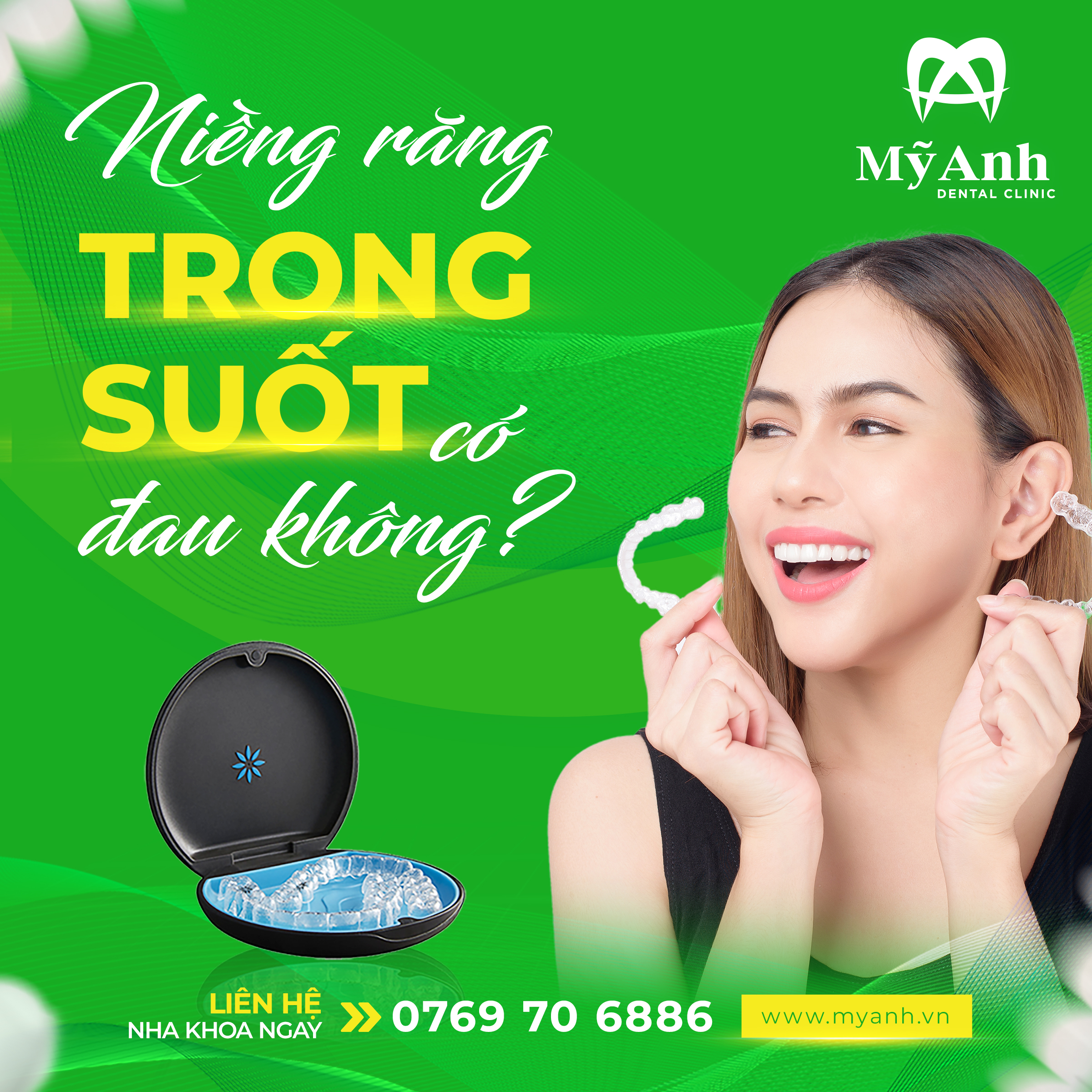 niềng răng trong suốt