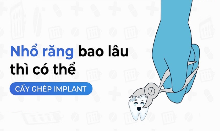 trồng implant