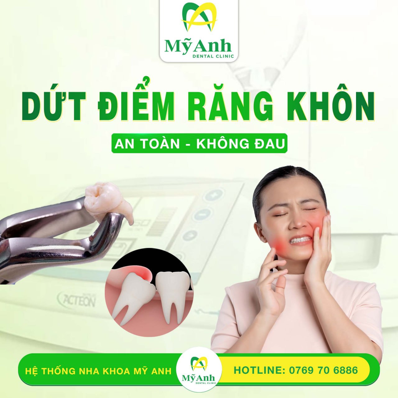 răng khôn bị sâu