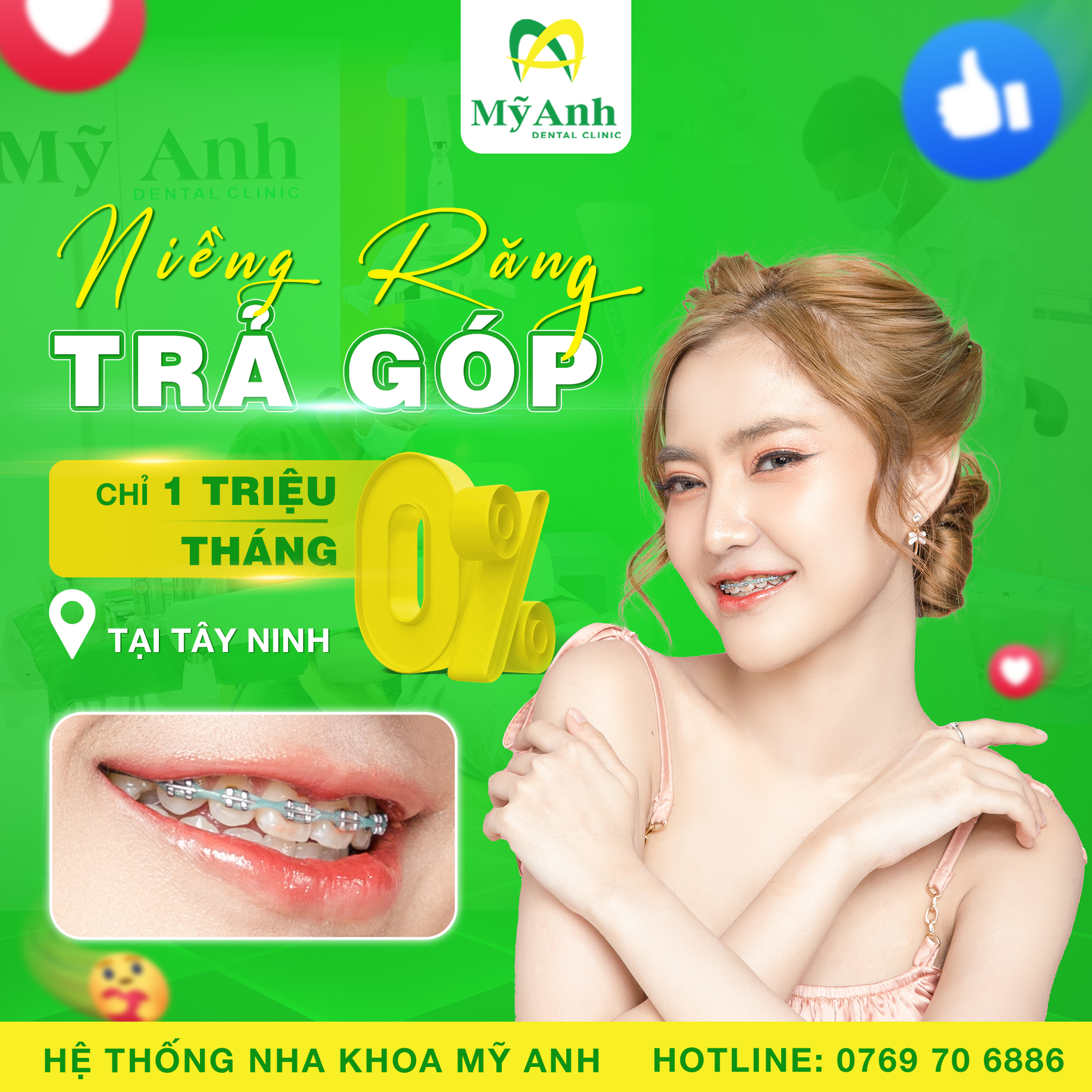 niềng răng trả góp tây ninh